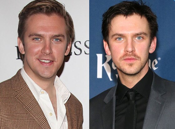 Dan Stevens Dan Stevens