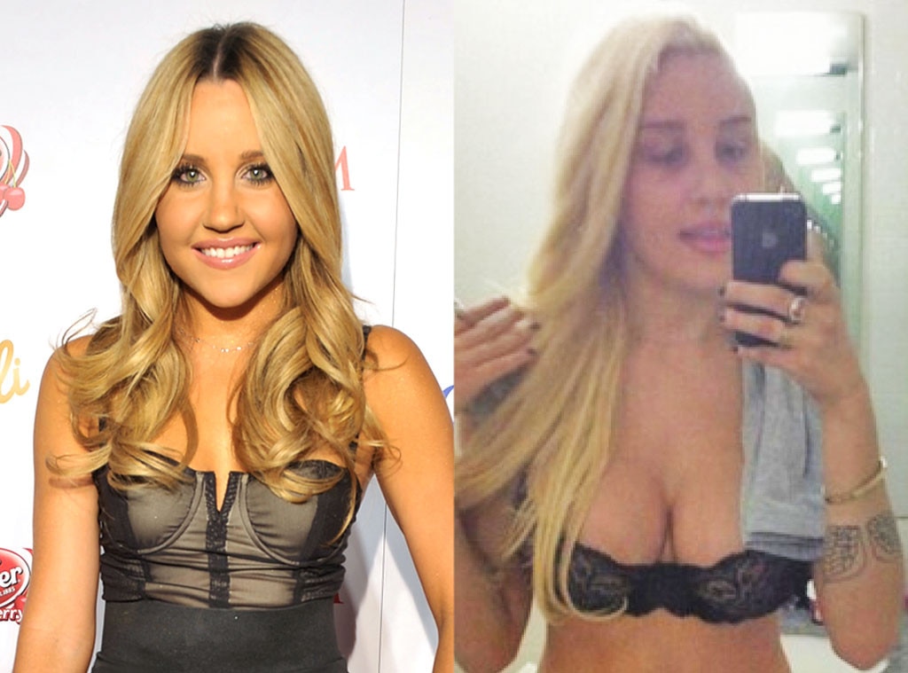 Amanda Bynes From Celebs Who Ve Admitted To Getting Plastic Surgery E News