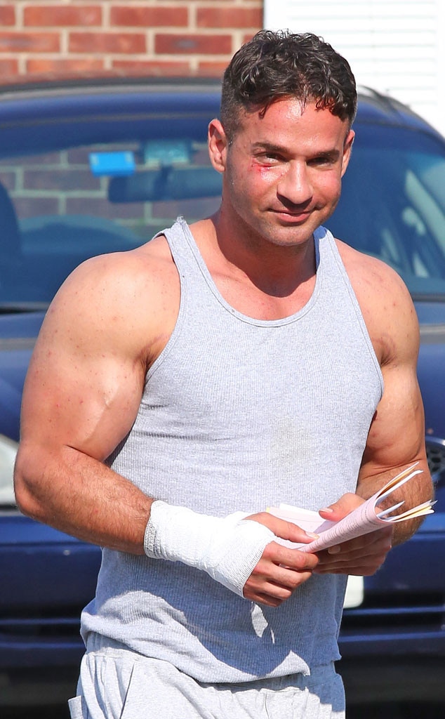 Mike The Situation Sorrentino Is All Bloody and Banged Up After Tanning