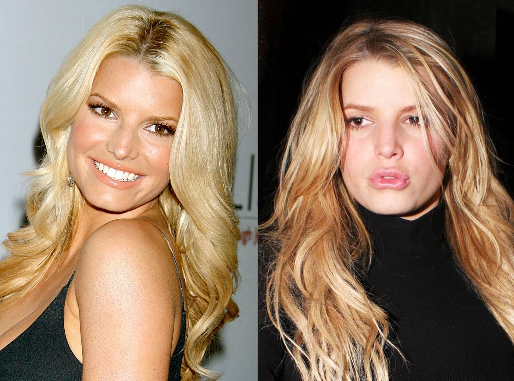 Jessica Simpson From Better Or Worse Celebs Who Have Had Plastic Surgery 3674