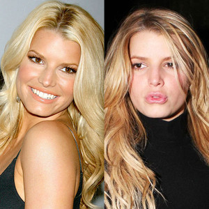 Jessica Simpson, Tori Spelling and More Regret Getting Plastic Surgery