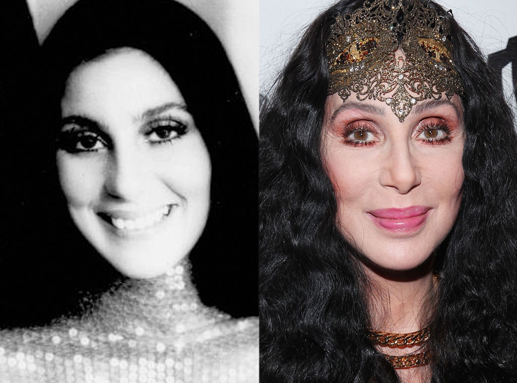 Cher From Better Or Worse Celebs Who Have Had Plastic Surgery 