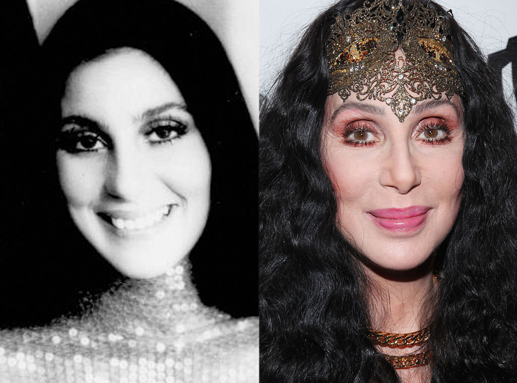 Cher from Better or Worse: Celebs Who Have Had Plastic Surgery