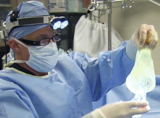 Breast Cancer Survivors Breast Implant Explodes During Surgery—watch The Insane Botched Clip