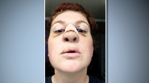 Botched Before And After A Transgender Surgery Addict A Cleft Lip And Much More—see The Season 