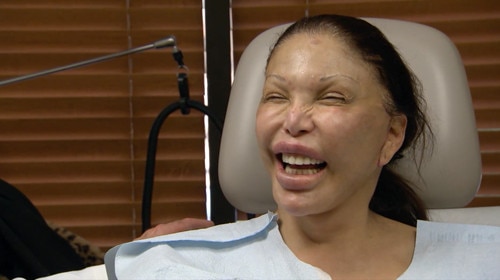 Botched Before And After A Transgender Surgery Addict A Cleft Lip And Much More—see The Season 5306