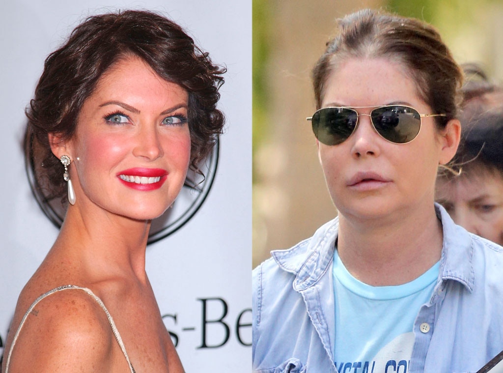 Lara Flynn Boyle from Face Changes That Shocked the World E! News