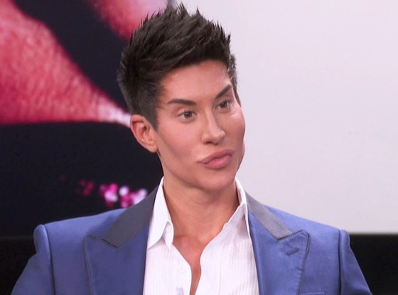 Human Ken Doll Justin Jedlica Risks Blindness To Have Veins In His