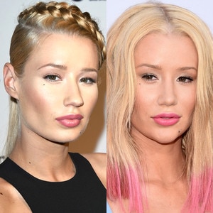 Did Iggy Azalea Get A Nose Job And Chin Implant? | E! News UK