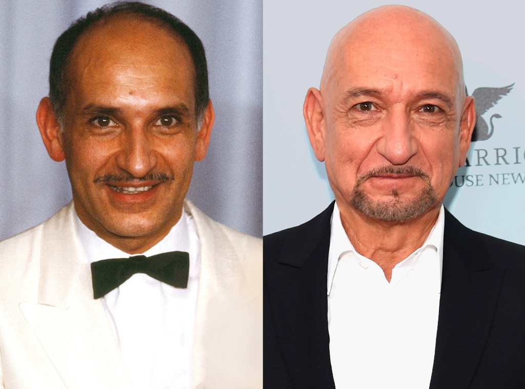 Sir Ben Kingsley, Hair