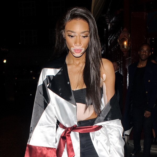 Winnie Harlow
