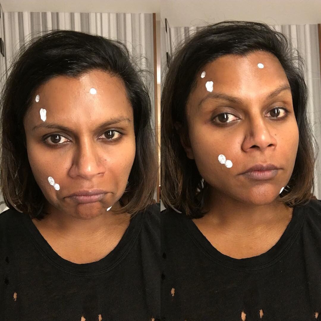 Mindy Kaling, Acne