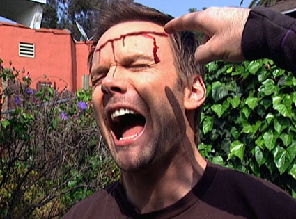Joel McHale with bleeding head
