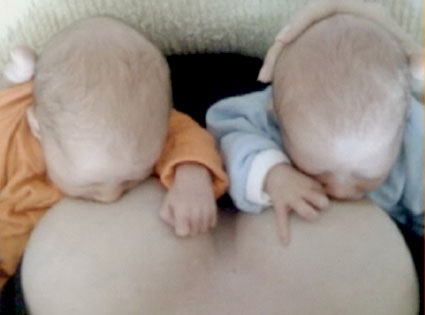 Twins Breastfeeding