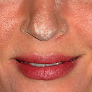 Which Celebrity Has Powder on Her Nose? E! Online