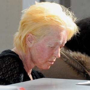 What Exactly Happened to Cyndi Lauper's Face? E! Online UK