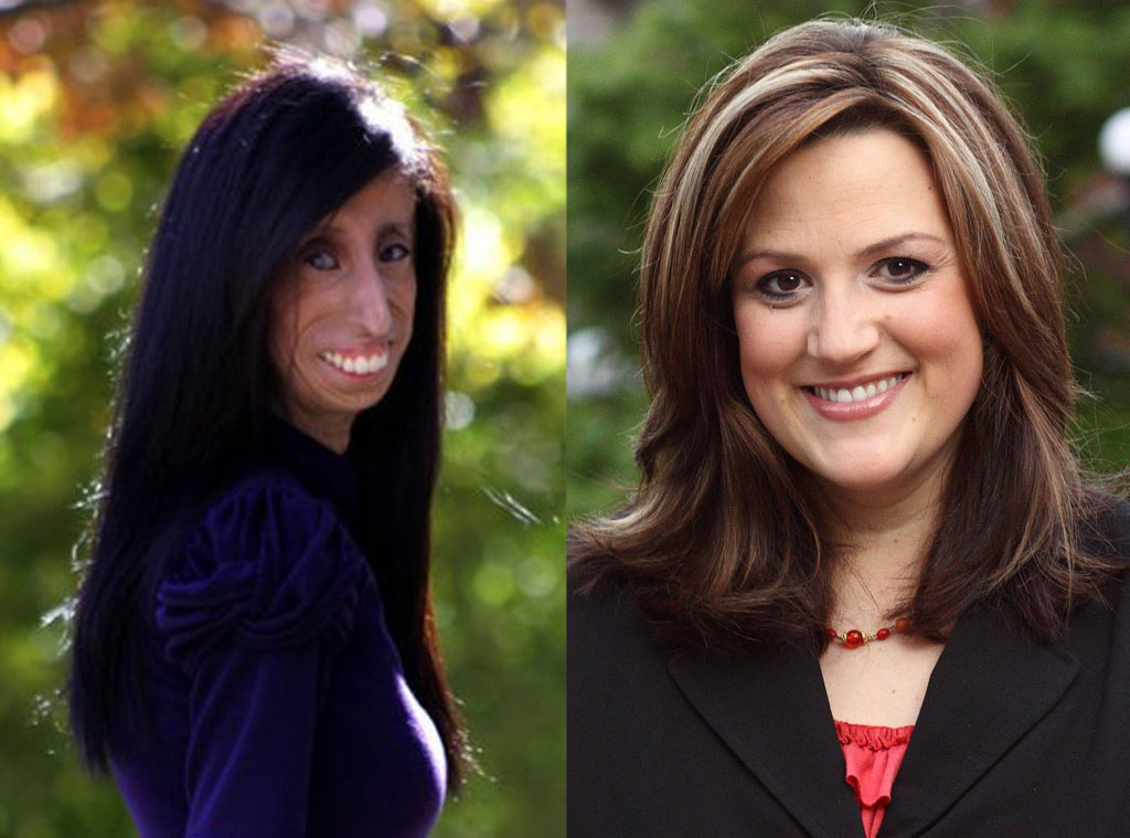 6 Lizzie Velasquez And Jennifer Livingston From Top 10 Most Inspiring 