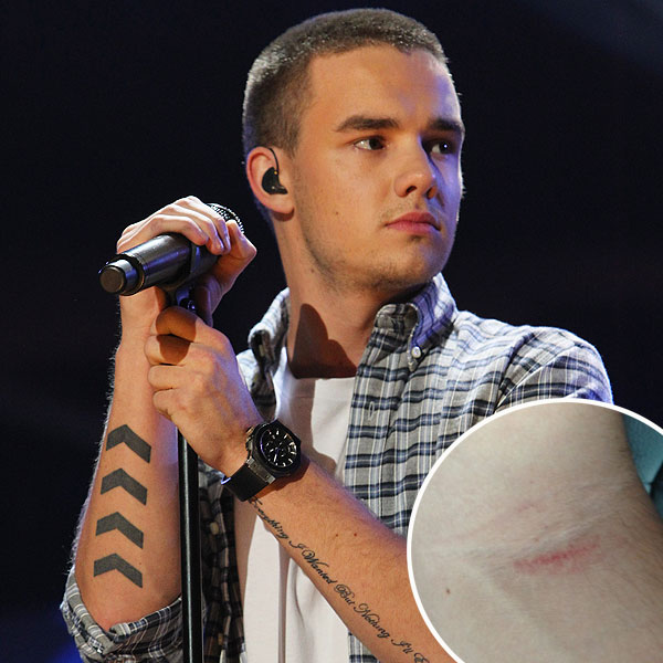 One Direction's Liam Payne Suffers Minor Injury After Fans Mob Boy Band