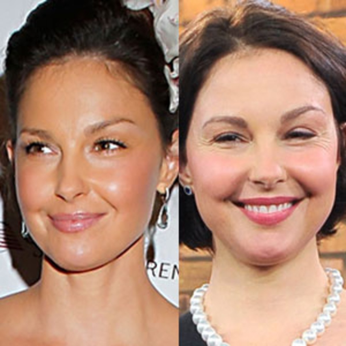 What Happened To Ashley Judd'S Face?