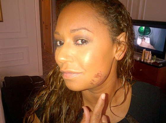 What Did Spice Girl Mel B Do To Her Face E News