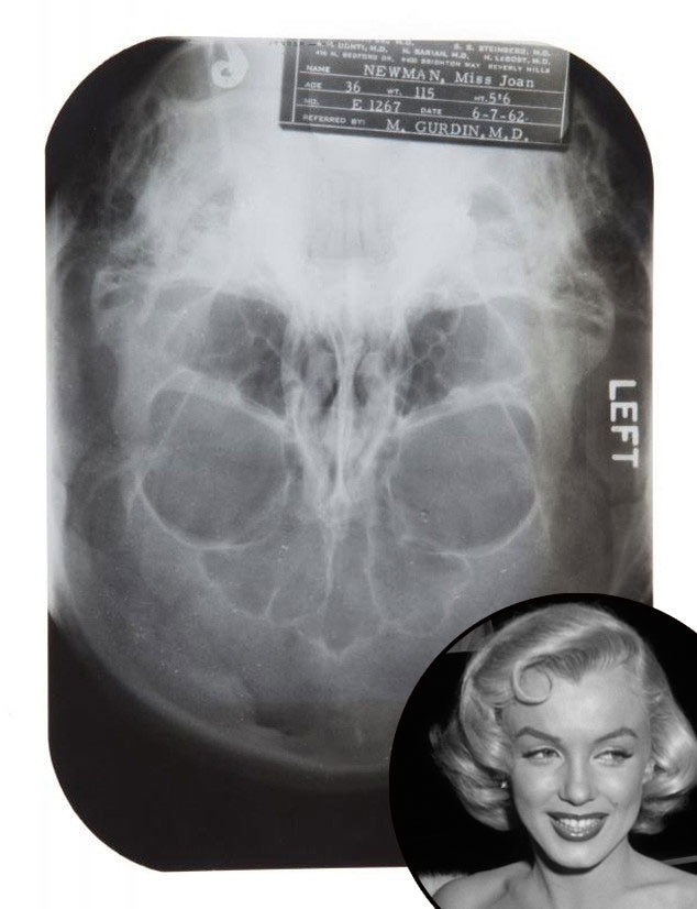 Marilyn Monroe, Plastic Surgery, X-Ray, Auction