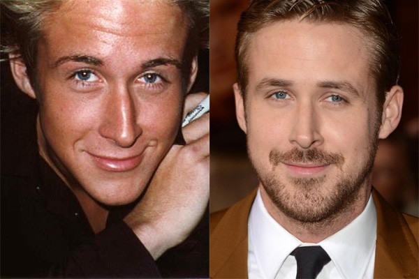 Ryan Gosling plástica nariz antes depois