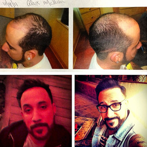 Backstreet Boys' A.J. McLean Proudly Admits to Getting Hair Transplant ...