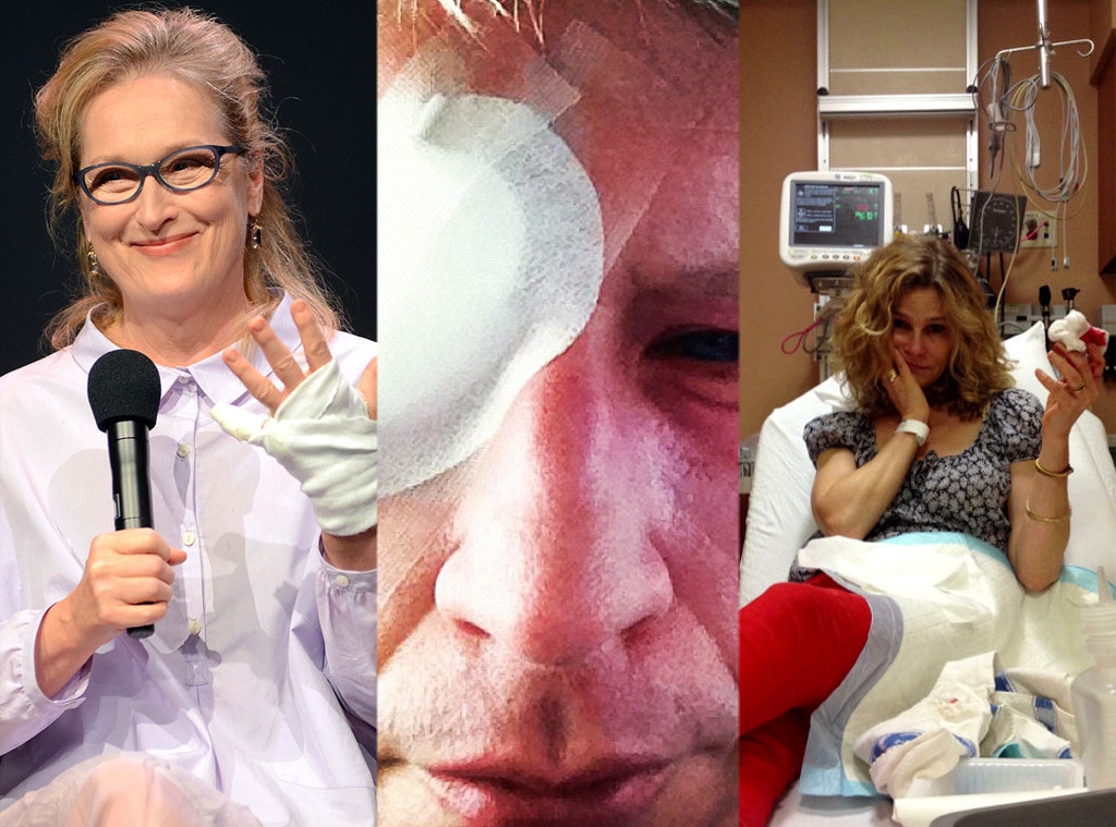 Celeb Injuries, Meryl Streep, Kyra Sedgwick, Anderson Cooper