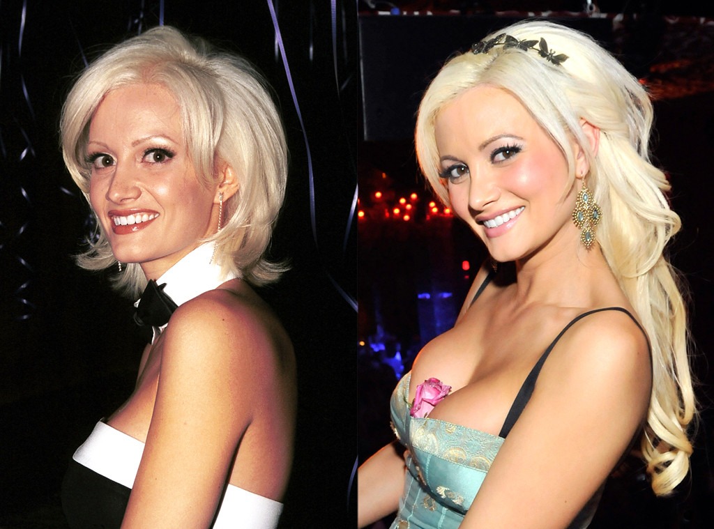 Holly Madison, Plastic Surgery Before And After