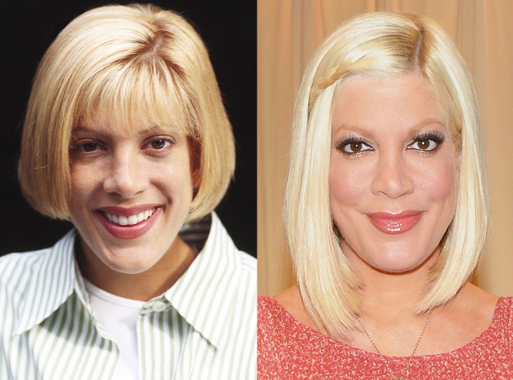 Tori Spelling From Celebs Who Ve Admitted To Getting Plastic Surgery   Rs 1024x759 130912142855 1024.Tori Spelling Before After.jl.091213 