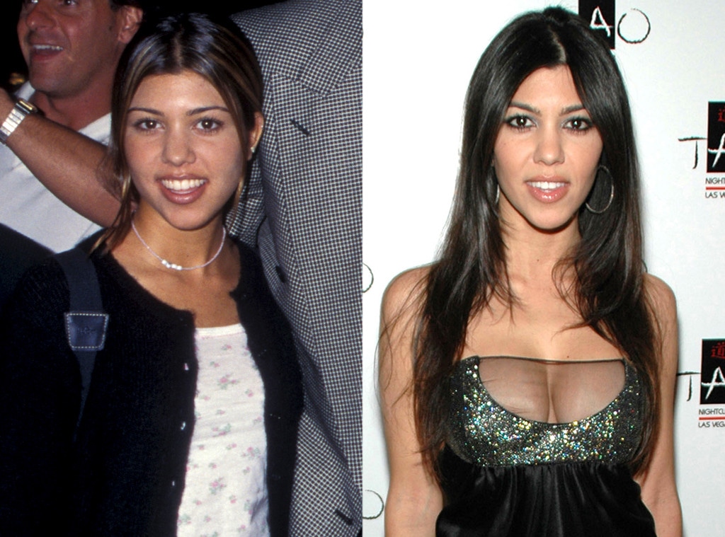Kourtney Kardashian, Plastic Surgery Before And After