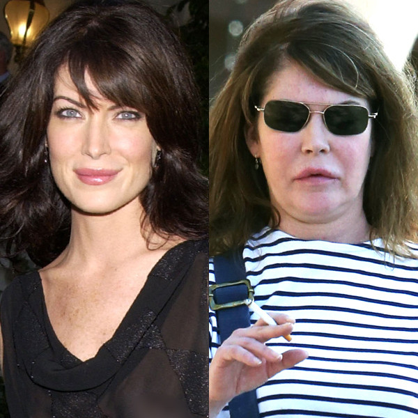 Лара флинн бойл до и после операции Lara Flynn Boyle Looks Nearly Unrecognizable