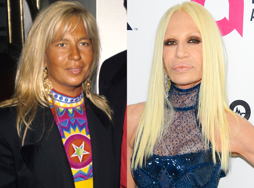 donatella versace - a before and after  Celebrity plastic surgery, Donatella  versace plastic surgery, Plastic surgery
