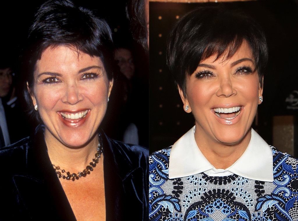 Kris Jenner From Better Or Worse Celebs Who Have Had Plastic Surgery