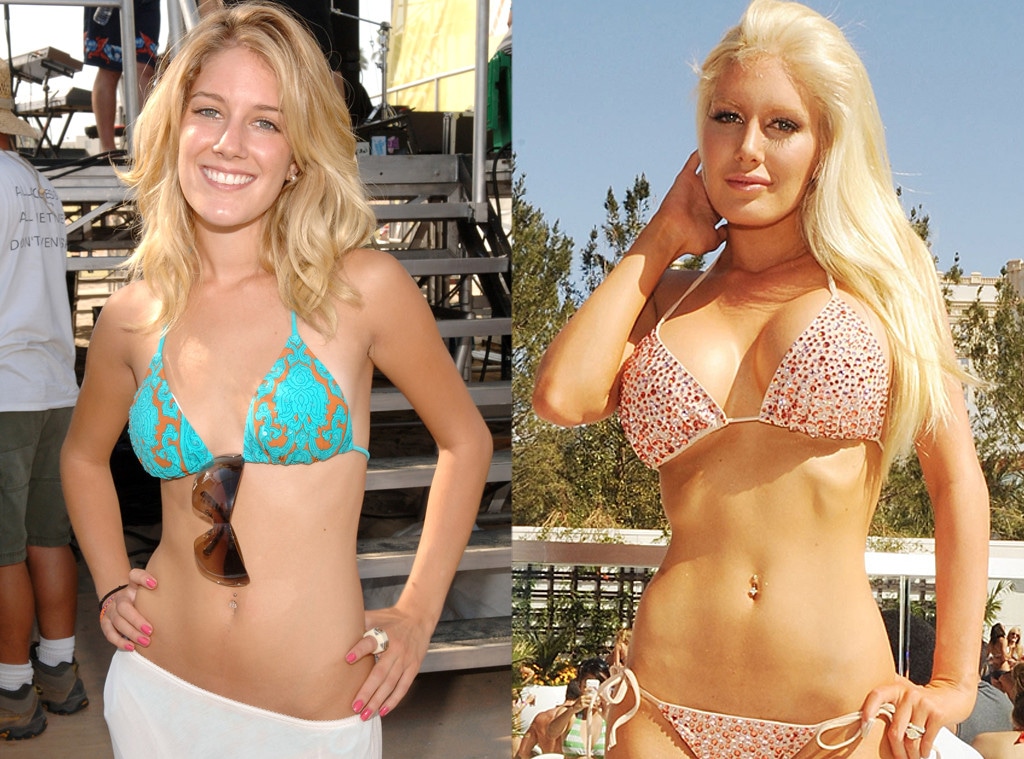 Heidi Montag, Plastic Surgery Transformations, Before and After