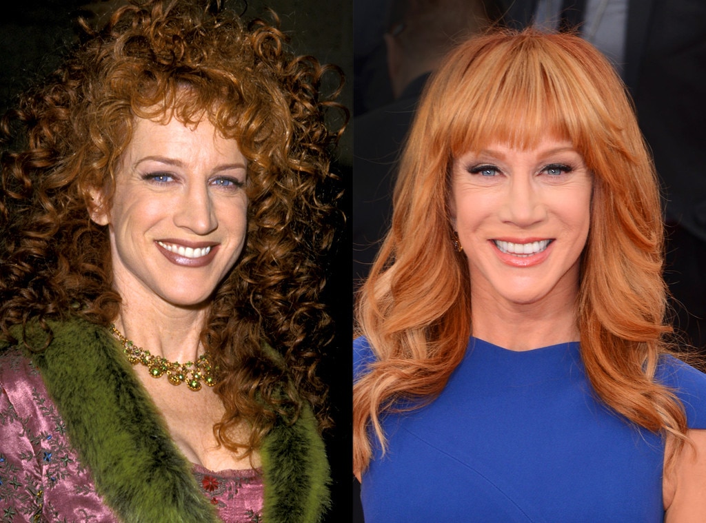 Kathy Griffin From Better Or Worse: Celebs Who Have Had Plastic Surgery ...