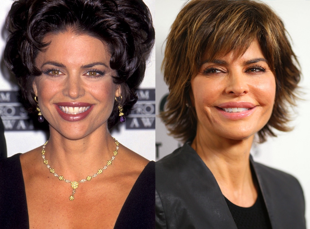 Lisa Rinna From Celebs Whove Admitted To Getting Plastic Surgery E News 
