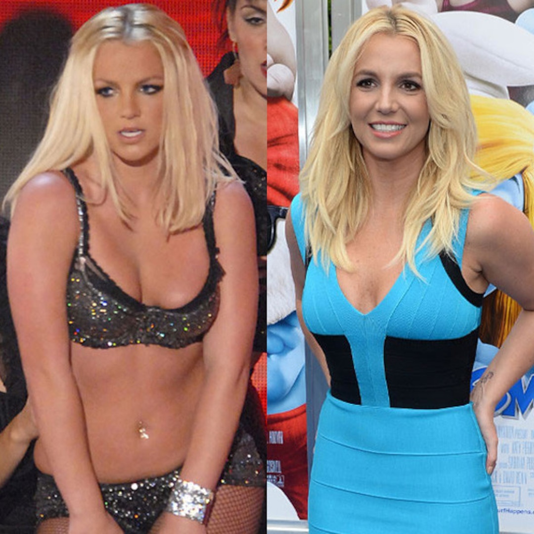 Photos from Better or Worse: Celebs Who Have Had Plastic Surgery - E! Online