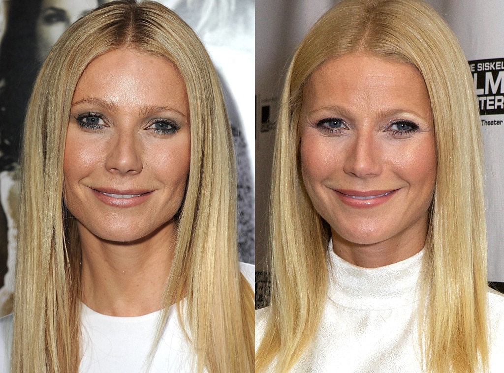 Plastic Surgery Celebrities: The Transformation Of Fame