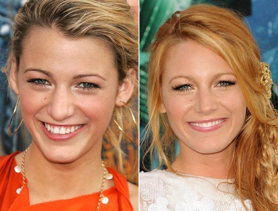 Blake Lively from As famosas com plástica no nariz | E! News