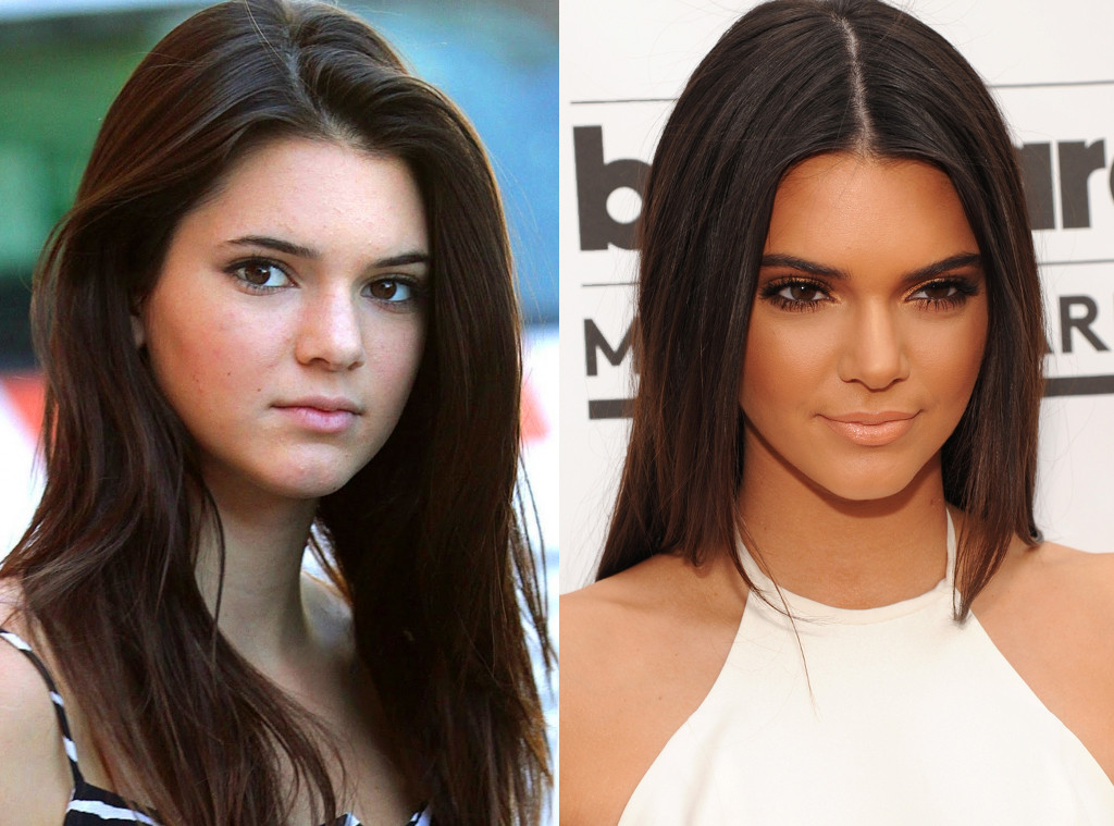 Kendall Jenner from Kardashians Without Makeup