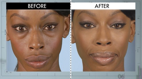 Botched Before & After: See All the Season Finale Pics! | E! News