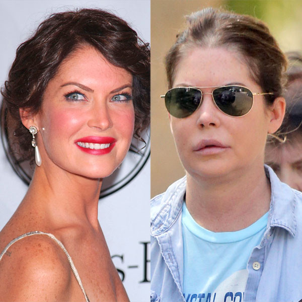 Lara Flynn Boyle, Is That Still You?