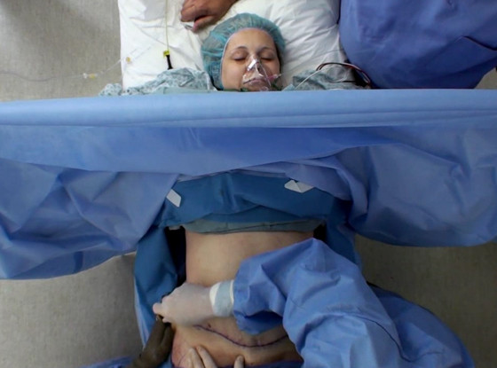 Terrified Patient Stays Awake During Her Tummy Tuck Surgery—see Cringeworthy Botched Clip On