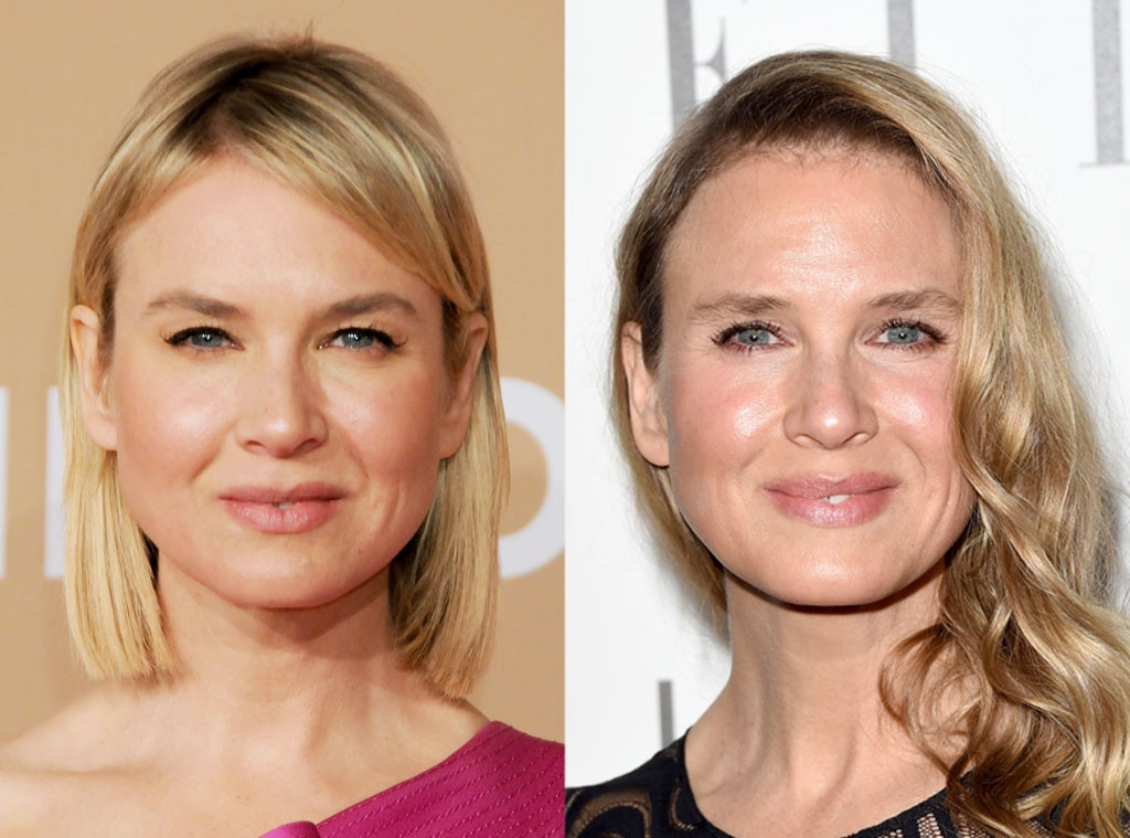 Renee Zellweger, Plastic Surgery Before and After