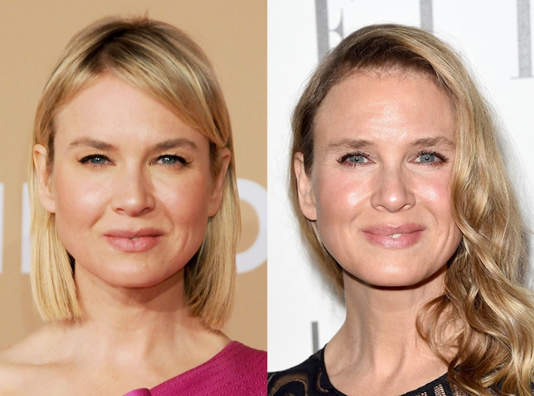 Renee Zellweger, Plastic Surgery Before and After