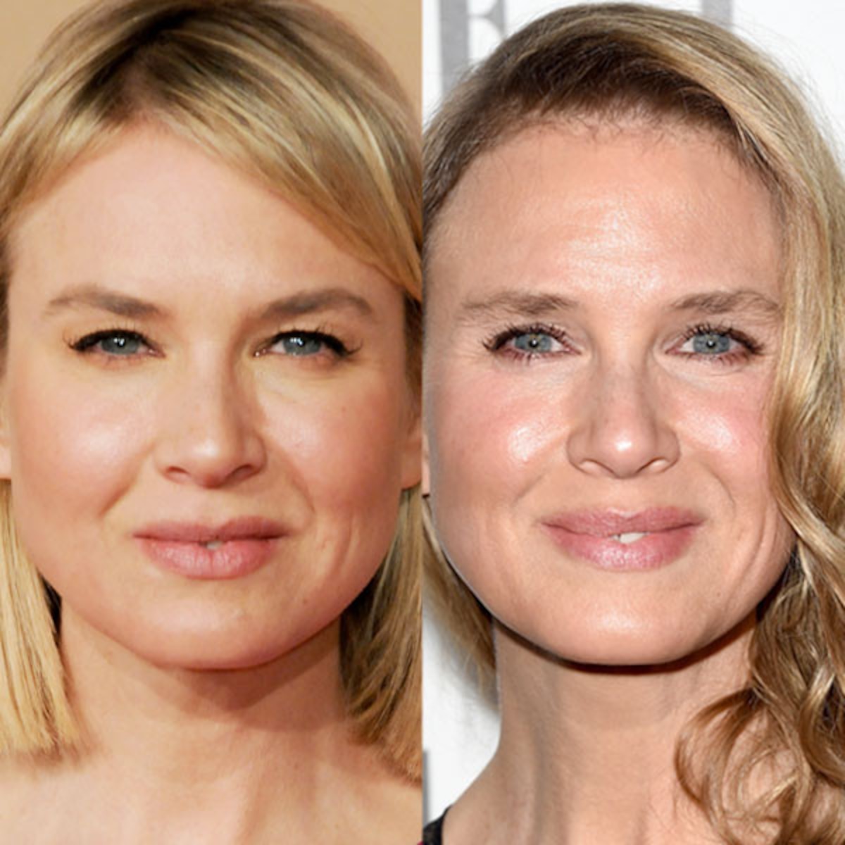 Renee Zellweger Explains Why Her Face Looks Different E Online Renee Zellweger Explains Why Her Face Looks Different E Online