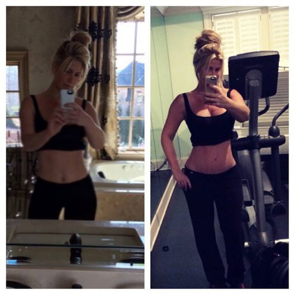 Kim Zolciak Shares Before and After Pics of Her Tummy Tuck