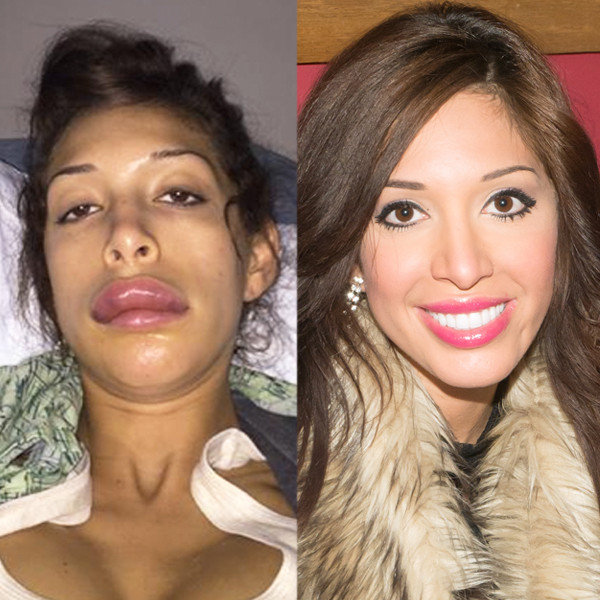Were Farrah Abraham S Botched Lip Injections Magically Fixed E Online Uk