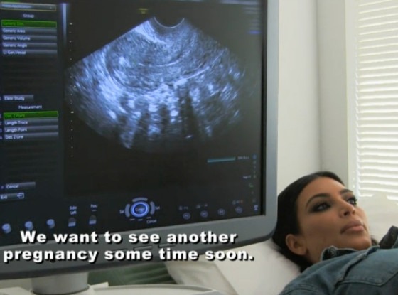 KUWTK Supertease